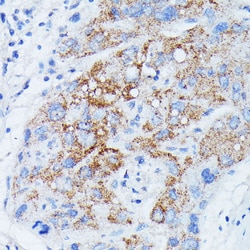 Invitrogen MANBA Polyclonal Antibody 100 &mu;L; Unconjugated:Antibodies,