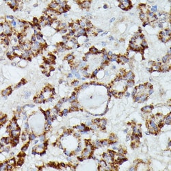 Invitrogen MANBA Polyclonal Antibody 100 &mu;L; Unconjugated:Antibodies,