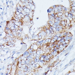 Invitrogen MANBA Polyclonal Antibody 100 &mu;L; Unconjugated:Antibodies,