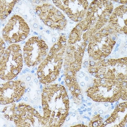 Invitrogen PLS1 Polyclonal Antibody 100 &mu;L; Unconjugated:Antibodies,