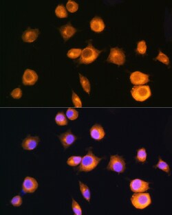 Invitrogen PRKAR2A Polyclonal Antibody 100 &mu;L; Unconjugated:Antibodies,
