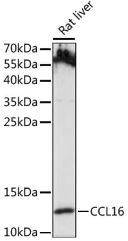 Invitrogen CCL16 Polyclonal Antibody 100 &mu;L | Buy Online | Invitrogen&trade; | Fisher Scientific