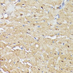 Invitrogen ASC1 Polyclonal Antibody 100 &mu;L | Buy Online | Invitrogen&trade; | Fisher Scientific