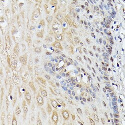Invitrogen ASC1 Polyclonal Antibody 100 &mu;L | Buy Online | Invitrogen&trade; | Fisher Scientific