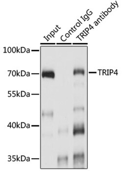 Invitrogen ASC1 Polyclonal Antibody 100 &mu;L | Buy Online | Invitrogen&trade; | Fisher Scientific