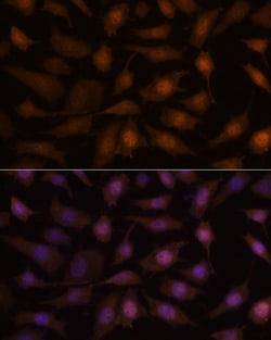 Invitrogen EEF1E1 Polyclonal Antibody 100 &mu;L; Unconjugated:Antibodies,