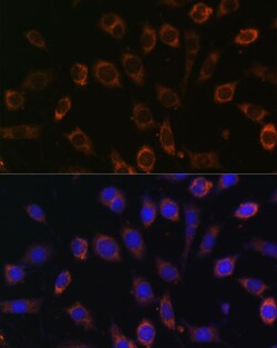 Invitrogen TCIRG1 Polyclonal Antibody 100 &mu;L; Unconjugated:Antibodies,