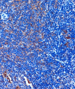Invitrogen TCIRG1 Polyclonal Antibody 100 &mu;L; Unconjugated:Antibodies,