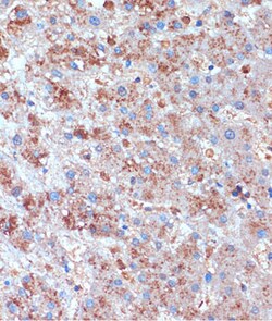 Invitrogen TCIRG1 Polyclonal Antibody 100 &mu;L; Unconjugated:Antibodies,