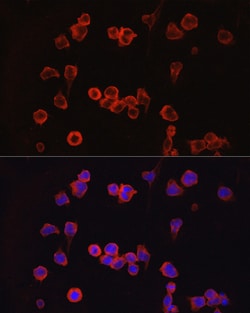 Invitrogen NFATC1 Polyclonal Antibody 100 &mu;L; Unconjugated:Antibodies,