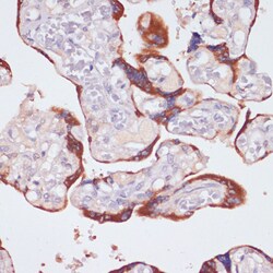 Invitrogen NFATC1 Polyclonal Antibody 100 &mu;L; Unconjugated:Antibodies,