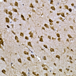 Invitrogen CPEB3 Polyclonal Antibody 100 &mu;L; Unconjugated:Antibodies,