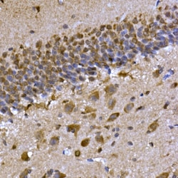Invitrogen CPEB3 Polyclonal Antibody 100 &mu;L; Unconjugated:Antibodies,
