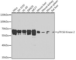 Invitrogen RPS6KB2 Polyclonal Antibody 100 &mu;L; Unconjugated:Antibodies,