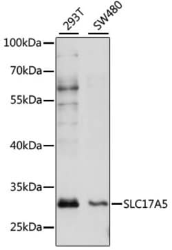 Invitrogen SLC17A5 Polyclonal Antibody 100 &mu;L; Unconjugated:Antibodies,