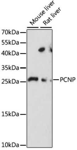 Invitrogen PCNP Polyclonal Antibody 100 &mu;L; Unconjugated:Antibodies,