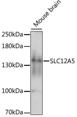 Invitrogen KCC2 Polyclonal Antibody 100 &mu;L; Unconjugated:Antibodies,