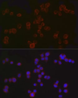 Invitrogen CD4 Polyclonal Antibody 100 &mu;L; Unconjugated:Antibodies,