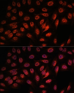 Invitrogen RBM25 Polyclonal Antibody 100 &mu;L; Unconjugated:Antibodies,