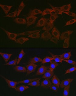 Invitrogen WNK3 Polyclonal Antibody 100 μL; Unconjugated:Antibodies,