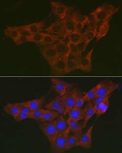 Invitrogen WNK3 Polyclonal Antibody 100 μL; Unconjugated:Antibodies,