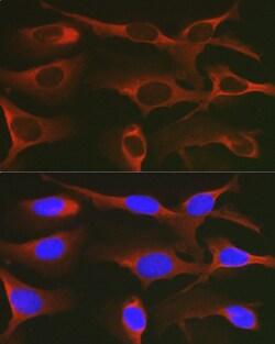 Invitrogen WNK3 Polyclonal Antibody 100 μL; Unconjugated:Antibodies,