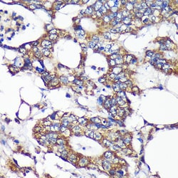 Invitrogen SLIRP Polyclonal Antibody 100 &mu;L; Unconjugated:Antibodies,