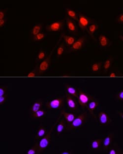 Invitrogen Hopx Polyclonal Antibody 100 &mu;L; Unconjugated:Antibodies,
