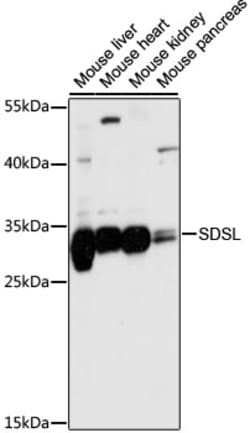 Invitrogen SDSL Polyclonal Antibody 100 &mu;L | Buy Online | Invitrogen&trade; | Fisher Scientific