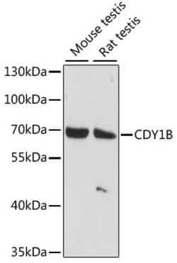 Invitrogen CDY1B Polyclonal Antibody 100 &mu;L; Unconjugated:Antibodies,