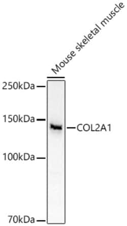 Invitrogen Collagen II Polyclonal Antibody 100 &mu;L; Unconjugated:Antibodies,