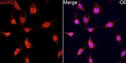 Invitrogen Acetyl-CoA Carboxylase Polyclonal Antibody 100 &mu;L; Unconjugated:Antibodies,