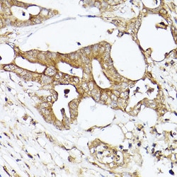 Invitrogen Acetyl-CoA Carboxylase Polyclonal Antibody 100 &mu;L; Unconjugated:Antibodies,