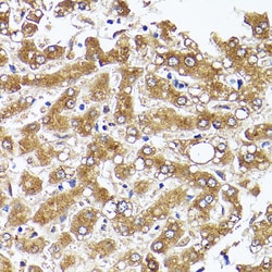 Invitrogen Acetyl-CoA Carboxylase Polyclonal Antibody 100 &mu;L; Unconjugated:Antibodies,