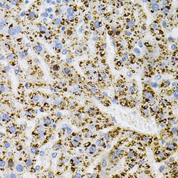Invitrogen TrkA Polyclonal Antibody 100 &mu;L; Unconjugated:Antibodies,
