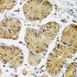 Invitrogen TrkA Polyclonal Antibody 100 &mu;L; Unconjugated:Antibodies,