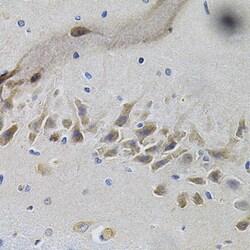 Invitrogen TrkA Polyclonal Antibody 100 &mu;L; Unconjugated:Antibodies,