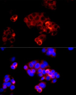 Invitrogen Angiotensinogen Polyclonal Antibody 100 &mu;L; Unconjugated:Antibodies,