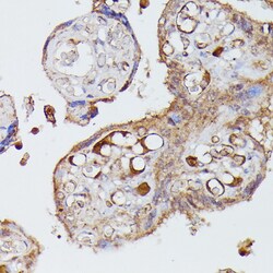 Invitrogen Angiotensinogen Polyclonal Antibody 100 &mu;L; Unconjugated:Antibodies,