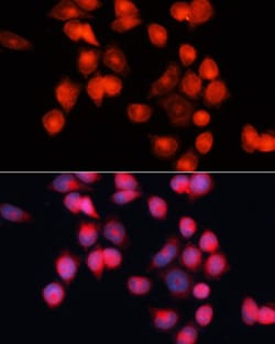 Invitrogen SLC25A5 Polyclonal Antibody 100 &mu;L; Unconjugated:Antibodies,