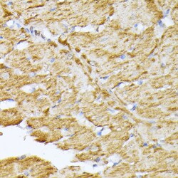 Invitrogen SLC25A5 Polyclonal Antibody 100 &mu;L; Unconjugated:Antibodies,