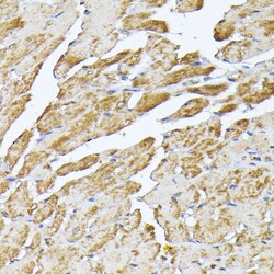 Invitrogen SLC25A5 Polyclonal Antibody 100 &mu;L; Unconjugated:Antibodies,