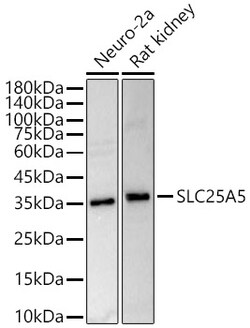 Invitrogen SLC25A5 Polyclonal Antibody 100 &mu;L; Unconjugated:Antibodies,