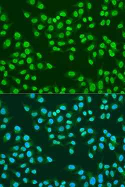 Invitrogen ATM Polyclonal Antibody 100 &mu;L; Unconjugated:Antibodies,