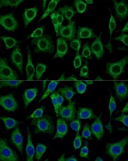 Invitrogen TSPO Polyclonal Antibody 100 &mu;L | Buy Online | Invitrogen&trade; | Fisher Scientific