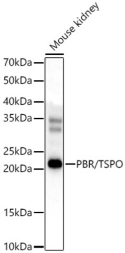 Invitrogen TSPO Polyclonal Antibody 100 &mu;L | Buy Online | Invitrogen&trade; | Fisher Scientific