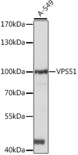 Invitrogen VPS51 Polyclonal Antibody 100 &mu;L; Unconjugated:Antibodies,