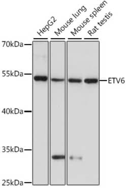 Invitrogen ETV6 Polyclonal Antibody 100 &mu;L; Unconjugated:Antibodies,