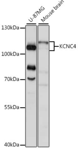 Invitrogen KV3.4 (KCNC4) Polyclonal Antibody 100 &mu;L | Buy Online | Invitrogen&trade; | Fisher Scientific