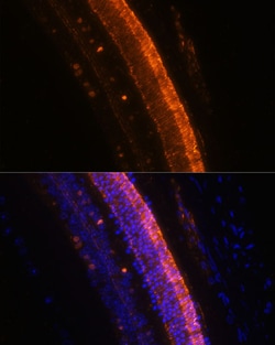Invitrogen KCNS2 Polyclonal Antibody 100 &mu;L; Unconjugated:Antibodies,